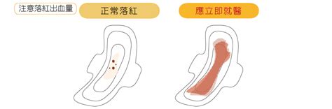 落紅|3大產兆如何判斷？落紅、破水、陣痛，代表我快生了。